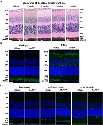 Retinal atrophy, inflammation, phagocytic and metabolic disruptions develop in the MerTK-cleavage-resistant mouse model